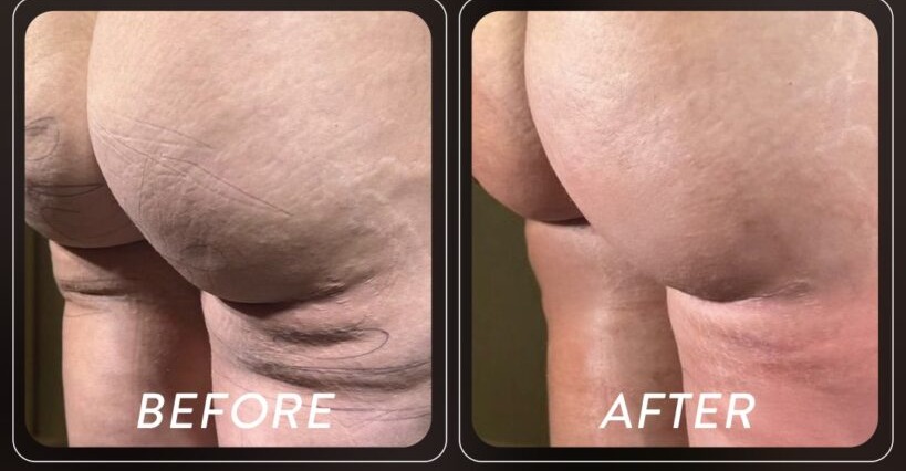 Before and after — Patient 01 · Post-treatment